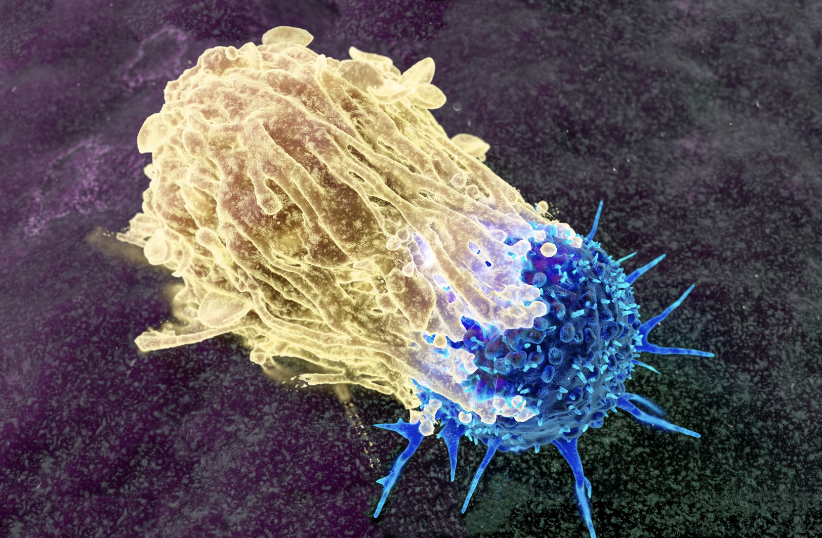 NANOPARTÍCULA ESPAÑOLA ABRE NUEVA ESPERANZA EN LA LUCHA CONTRA EL CÁNCER